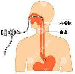 泉州胃肠医院 泉州医博医院 泉州看痔疮的医院 泉州肛瘘医院 泉州肛裂医院 泉州肠炎医院