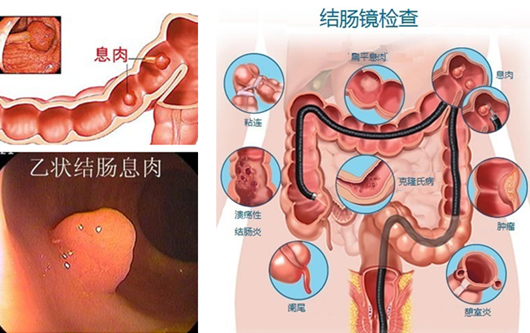 泉州哪家医院看胃病治疗不错
