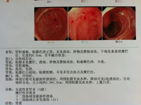 泉州治疗十二指肠溃疡去哪家医院