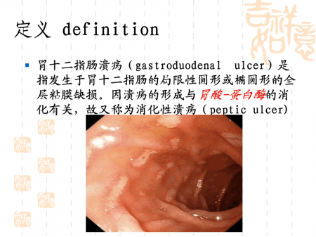 泉州治疗十二指肠溃疡去哪家医院